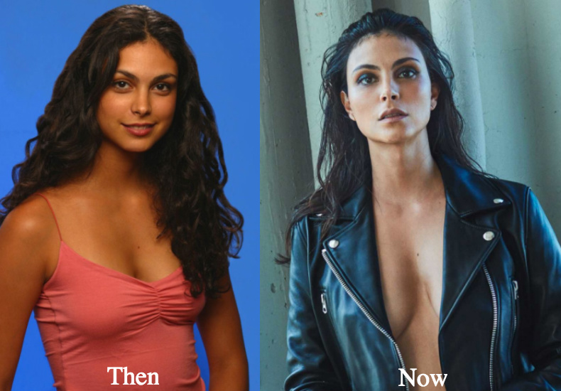 Morena Baccarin breast augmentation before and after