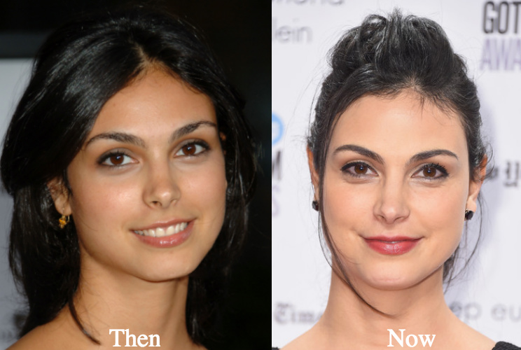 Morena baccarin facelift before and after