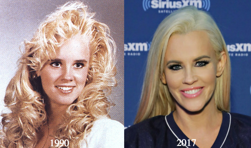 jenny mccarthy plastic surgery before and after photos comparison