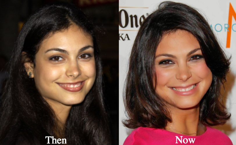 morena baccarin botox before and after