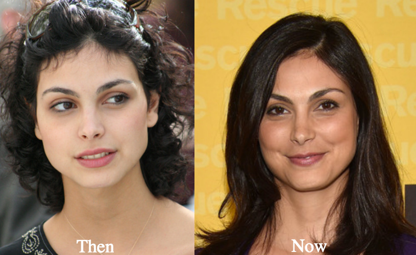 morena baccarin nose job before and after