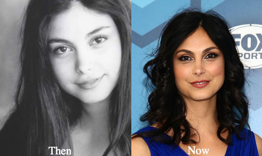 morena baccarin rhinoplasty before and after