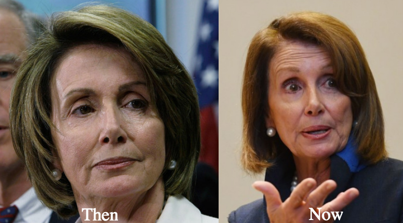 nancy pelosi facelift before and after