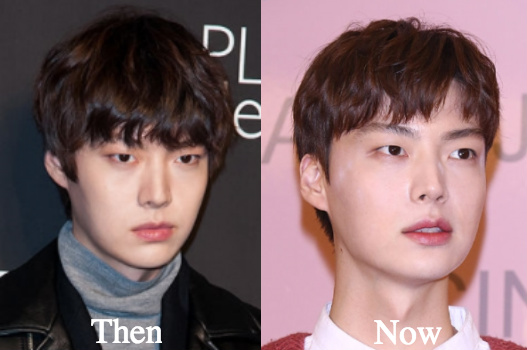 Ahn Jae Hyun before and after