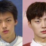 Ahn Jae Hyun Plastic Surgery Before and After Photos