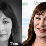 Anjelica Huston Plastic Surgery Before and After Photos – Awful!