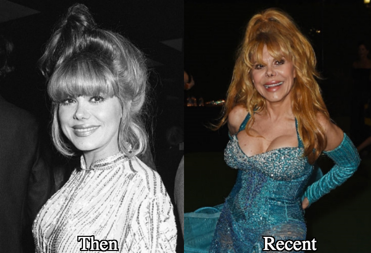 Charo boob job before and after