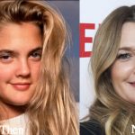 Drew Barrymore Plastic Surgery Before and After Photos