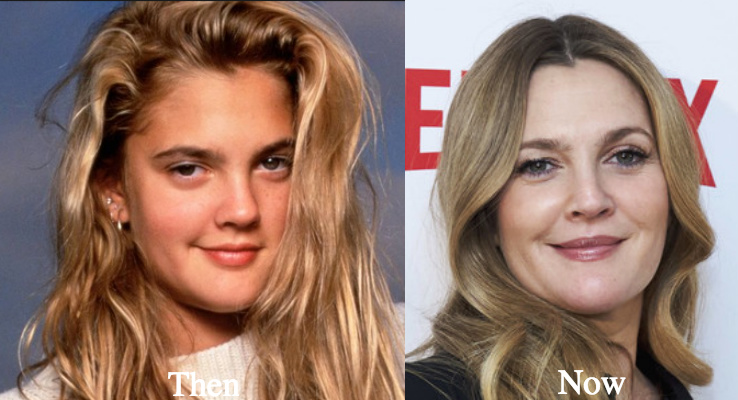Drew Barrymore plastic surgery before and after photos