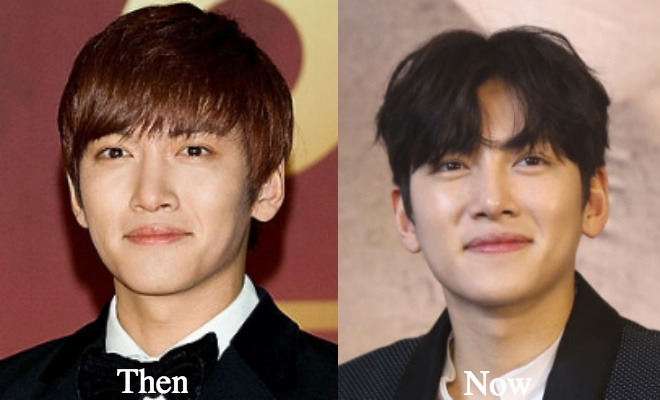 Ji Chang Wook eyelid makeover surgery before and after
