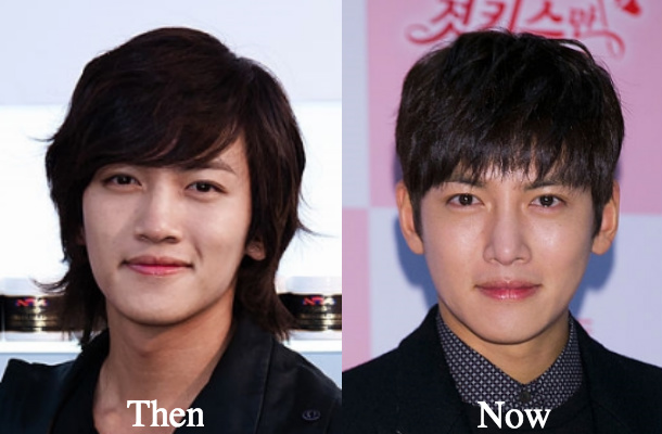 Ji Chang Wook eyelid surgery eye before and after