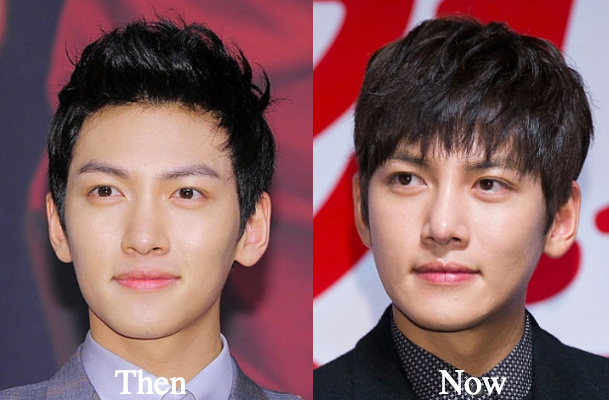 Ji Chang Wook jaw surgery before and after