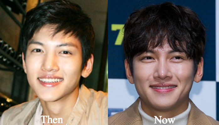 Ji Chang Wook plastic surgery before and after photos