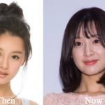 Kim Ji Won Plastic Surgery Before and After Photos