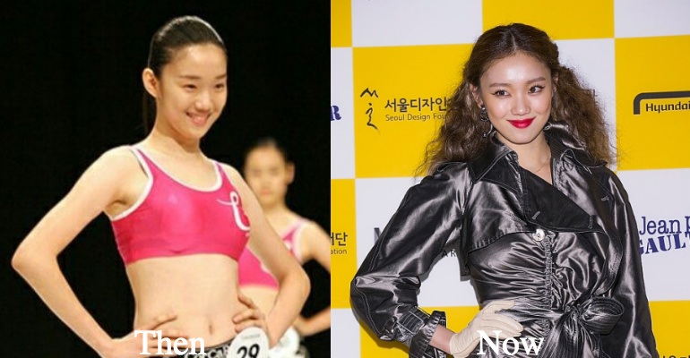 Lee Sung Kyung before and after