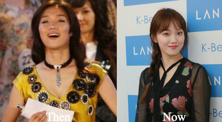 Lee Sung Kyung plastic surgery before and after photos