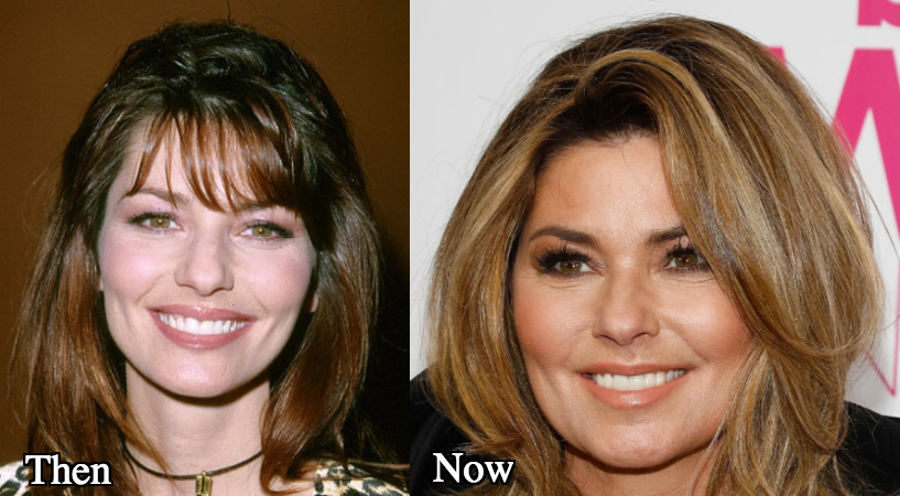 Shania Twain before and after photos