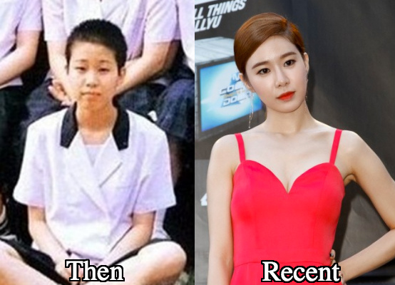 Yoo In Na Jaw Surgery before and after