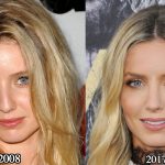 Annabelle Wallis Nose Job Plastic Surgery Before and After Photos