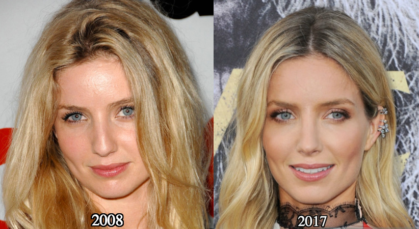 Annabelle Wallis nose job before and after pictures