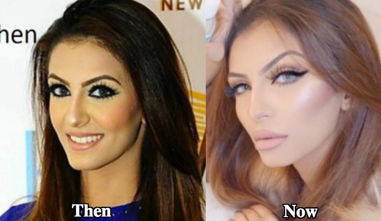 Faryal Makhdoom nose job before and after photos