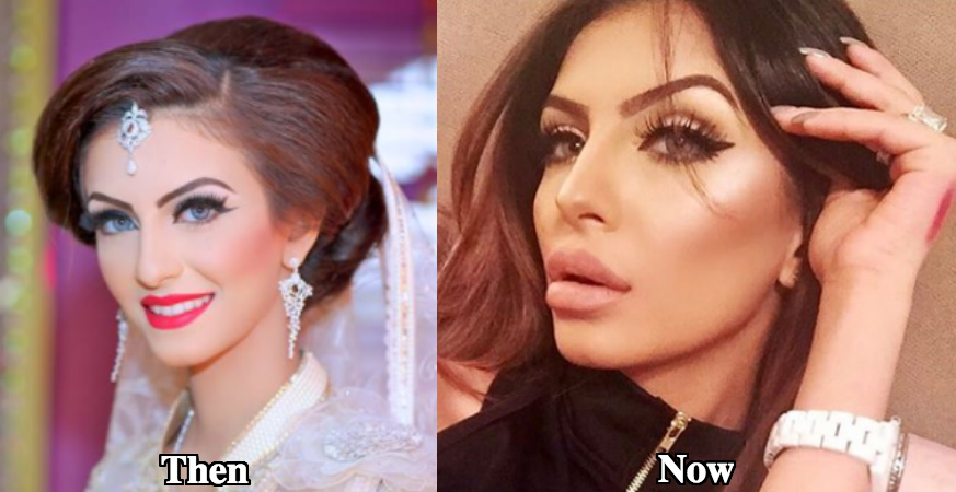 Faryal Makhdoom nose job before and after pictures