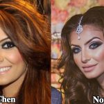 Faryal Makhdoom Plastic Surgery Before and After Photos