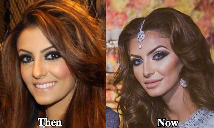 Faryal Makhdoom plastic surgery before and after photos