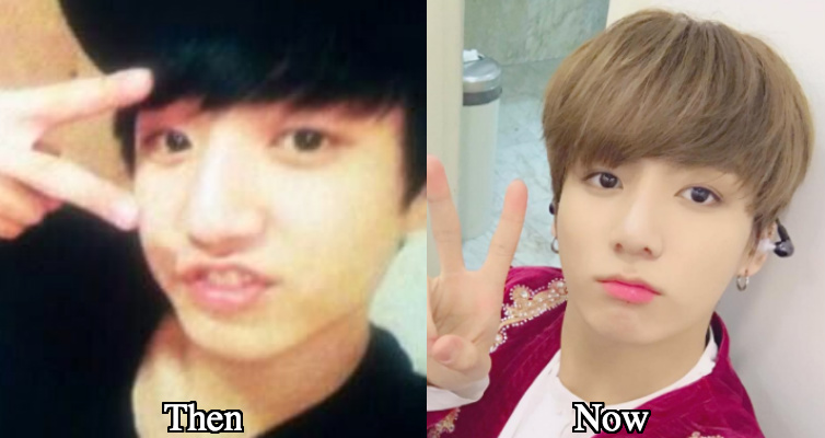 Jungkook big round nose surgery before and after