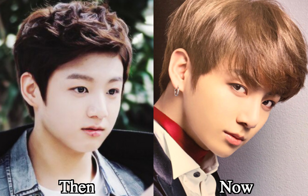 Jungkook double eyelid surgery before and after