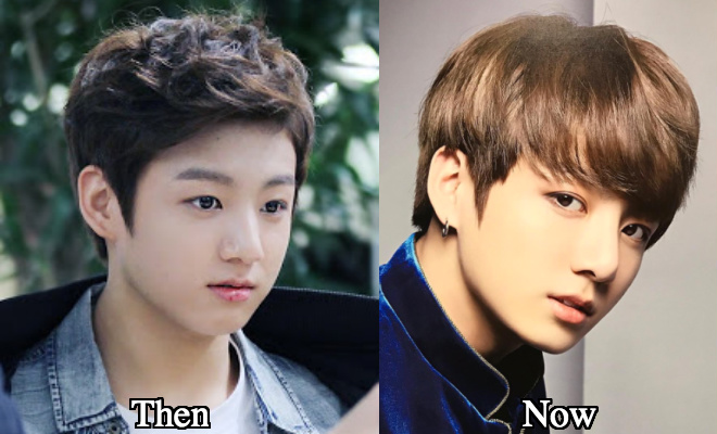 Jungkook eyelid surgery before and after photos