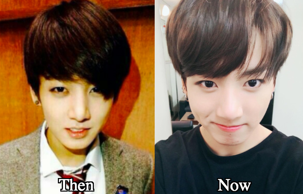 Jungkook nose job before and after photos