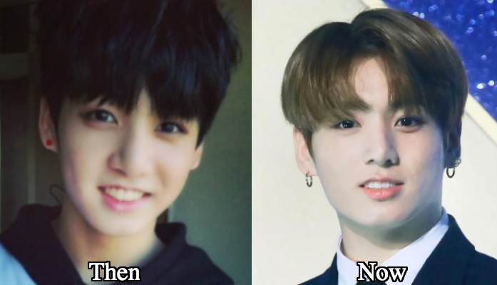 Jungkook plastic surgery before and after photos