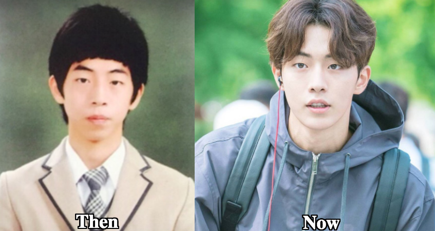 Nam Joo Hyuk plastic surgery before and after photos