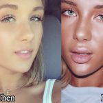 Niykee Heaton Plastic Surgery Before and After Photos