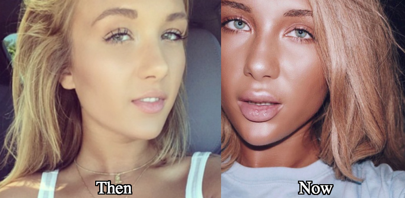 Niykee Heaton plastic surgery before and after photos