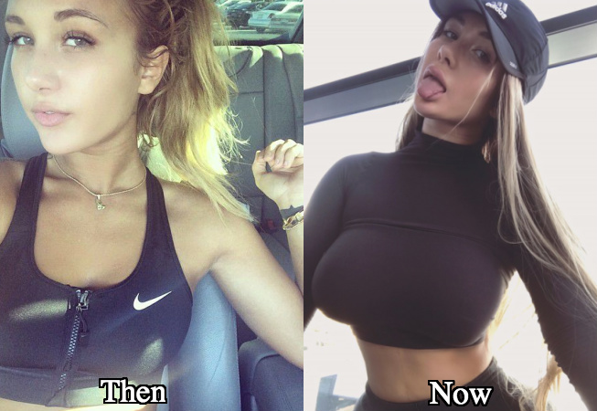 Niykee heaton boob job before and after photos