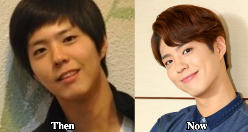 Park Bo Gum chin sharper before and after