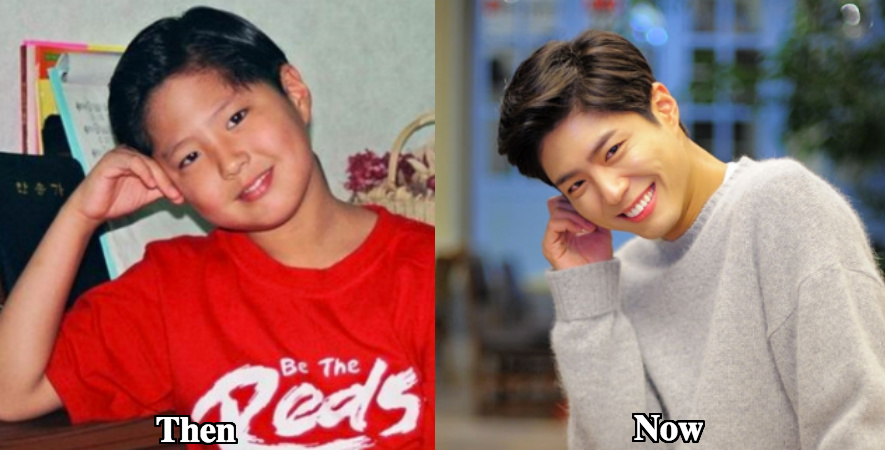 Park Bo Gum chin surgery before and after photos