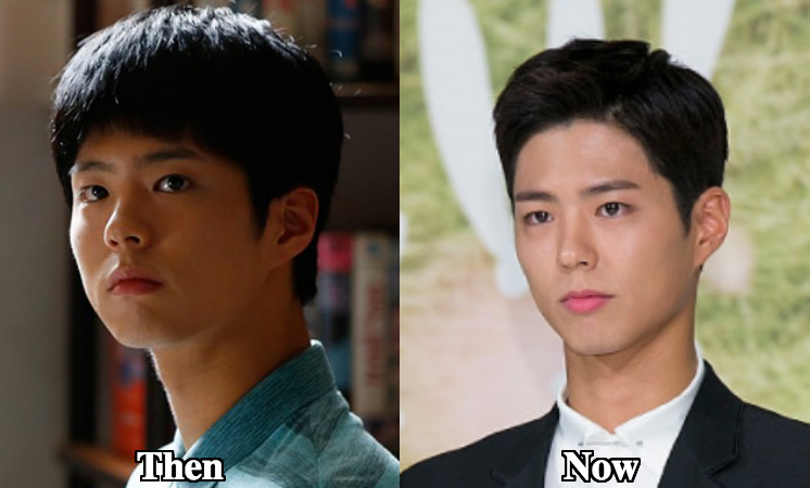 Park Bo Gum nose job before and after photos