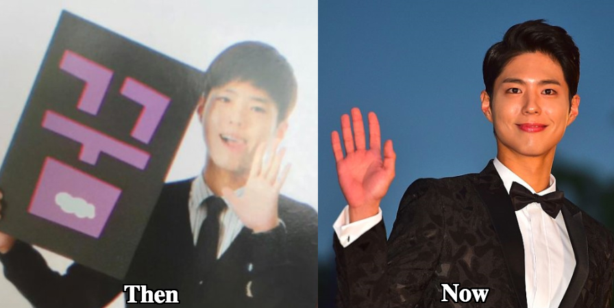 Park Bo Gum nose shape before and after