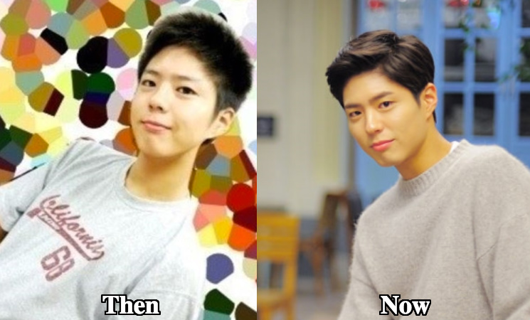 Park Bo Gum nose surgery before and after photos