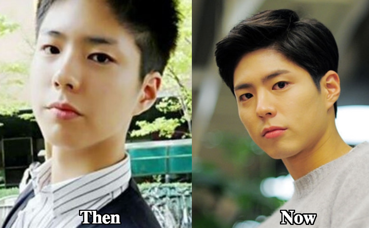 Park Bo Gum plastic surgery rumors before and after