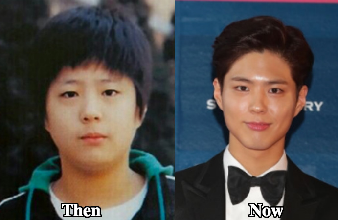 Park bo Gum Rhinoplasty before and after photos