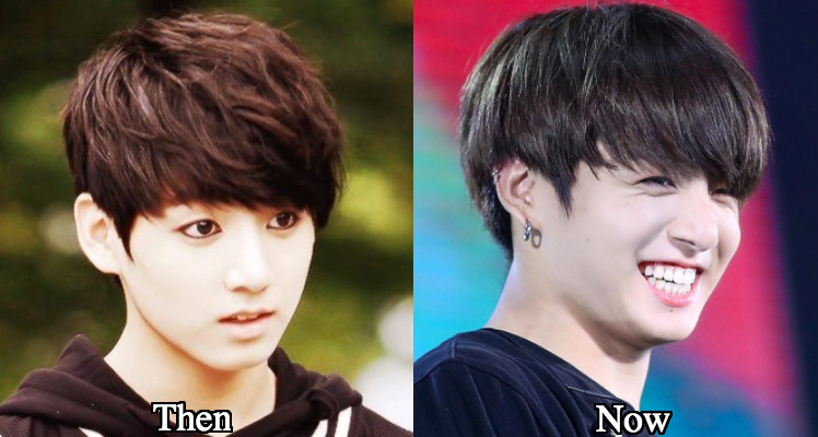 jungkook nose shape change surgery before and after