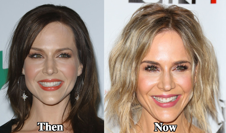 Julie Benz botox before and after