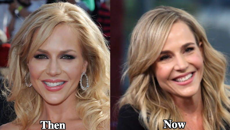 Julie Benz botox use before and after