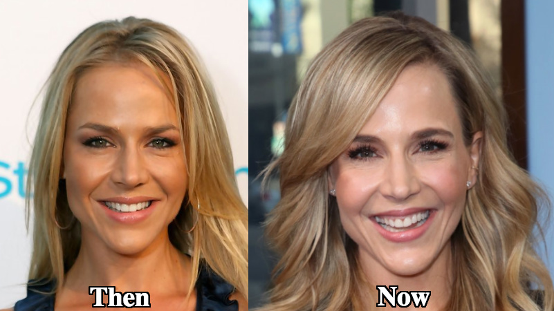 Julie Benz plastic surgery before and after photos