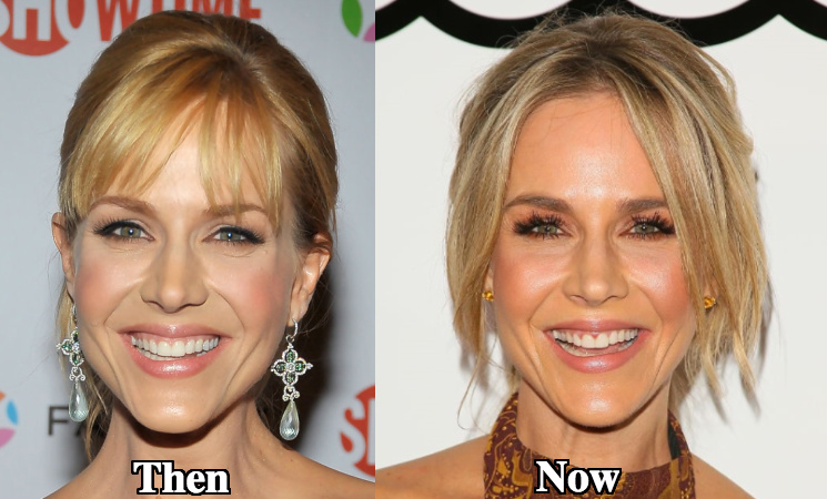 Julie benz cosmetic surgery before and after