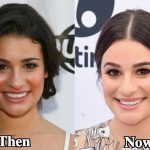 Lea Michele Nose Job Plastic Surgery Before and After Photos